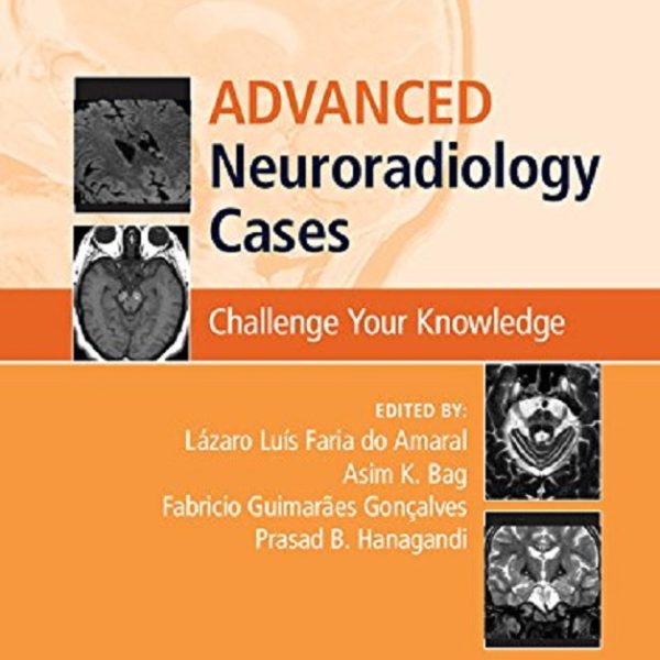 دانلود کتاب Advanced Neuroradiology Cases: Challenge Your Knowledge