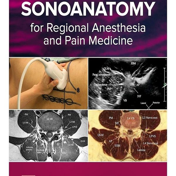 دانلود کتاب Atlas of Sonoanatomy for Regional Anesthesia and  Pain Medicine