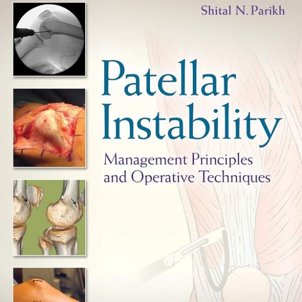 دانلود کتاب Patellar Instability: Management Principles and Operative Techniques