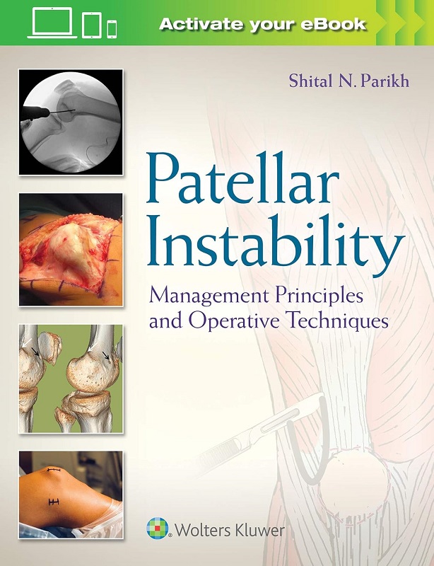 دانلود کتاب Patellar Instability: Management Principles and Operative Techniques