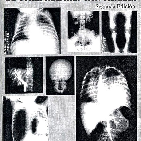 دانلود کتاب Radiologia de torax para atención primaria Hernandez Moreno Berzosa