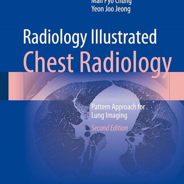 دانلود کتاب Radiology Illustrated: Chest Radiology