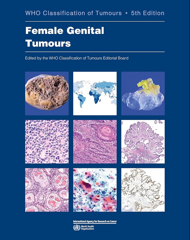 دانلود کتاب Who Classification of Tumours: Female Genital Tumours