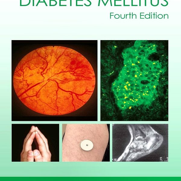 دانلود کتاب Atlas of Diabetes Mellitus 4E 2024