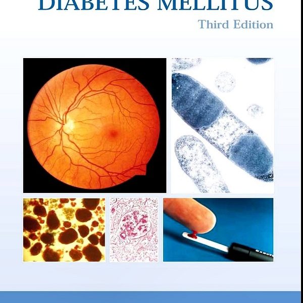 دانلود کتاب atlas de diabetes mellitus