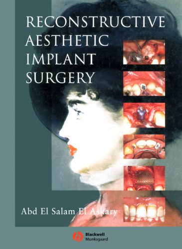 خرید و دانلود نسخه کامل کتاب Reconstructive Aesthetic Implant Surgery
